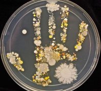 微生物检测的重要性有哪些？